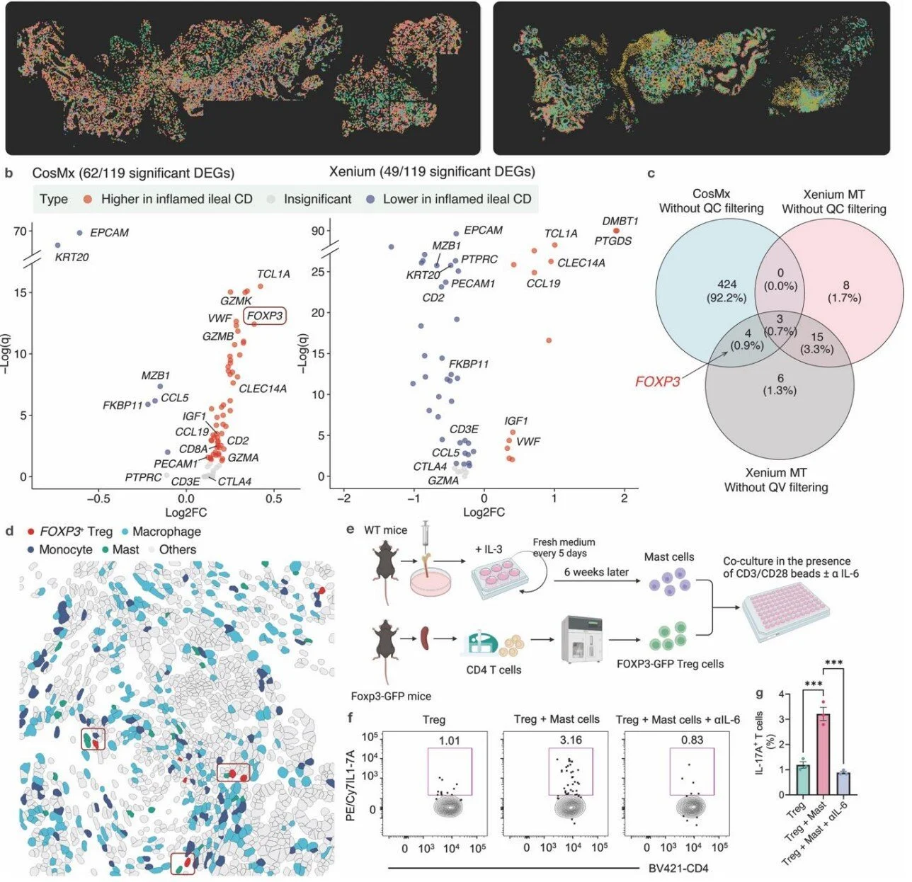 Spatial transcriptomics допомагає досліджувати хвороби кишківника